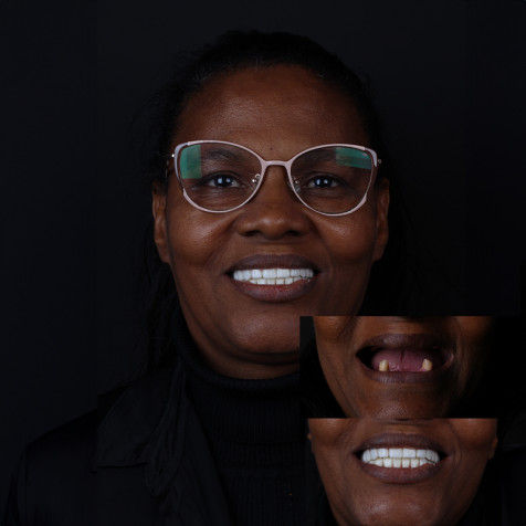 Patient Experiences 3