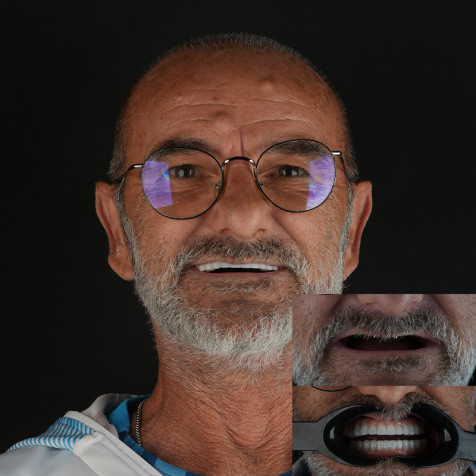 Patient Experiences 4